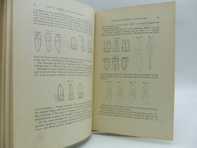 Practical Treatise on Artificial Crown, Bridge, and Porcelain Work